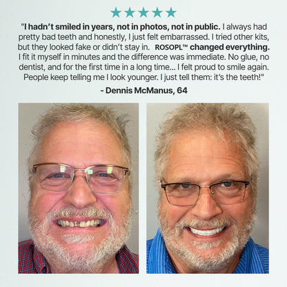 -🦷HazyGalaxy™ Custom-Fit Functional Dentures — Made in the USA, Up to 70% OFF for a More Confident Smile!