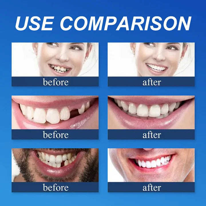 🌟Ends Today: 70% OFF! ⏰DarkFairy™ Medical Full Denture with Strong Suctiond🦷