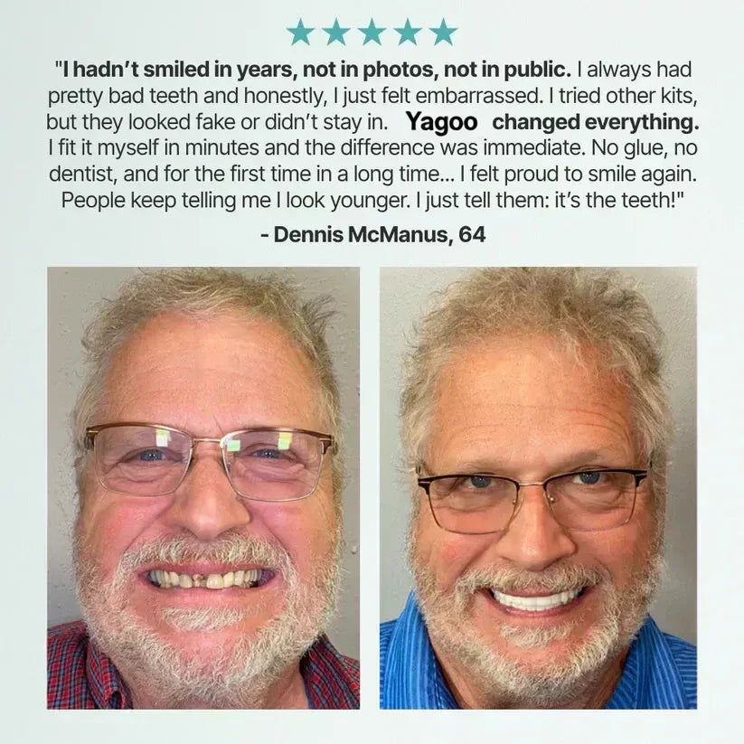 🏆Ends Today: 50% OFF!  🏆2026 Bestselling Product🦷 Fit for a Fresh Smile, Say Goodbye to Wearing Discomfort!🌎