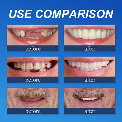 🌟Ends Today: 70% OFF! ⏰DarkFairy™ Medical Full Denture with Strong Suctiond🦷