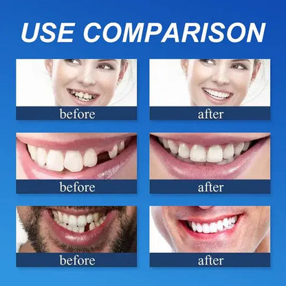🏆Ends Today: 50% OFF!  🏆2026 Bestselling Product🦷 Fit for a Fresh Smile, Say Goodbye to Wearing Discomfort!🌎