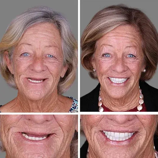 🏆Ends Today: 50% OFF!  🏆2026 Bestselling Product🦷 Fit for a Fresh Smile, Say Goodbye to Wearing Discomfort!🌎